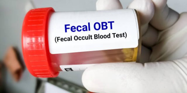 Mengenal Occult Bleeding, Pendarahan Tersembunyi yang Sering Tak Disadari